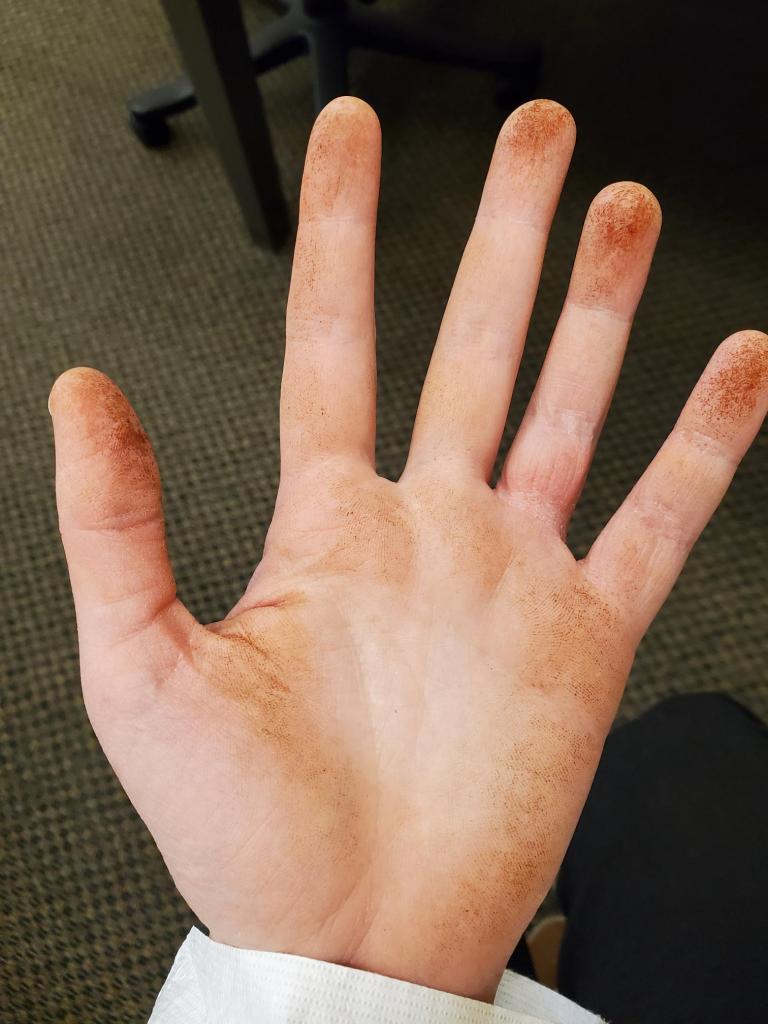 Photograph of a hand with dirt showing on the palm and pads of the fingers.